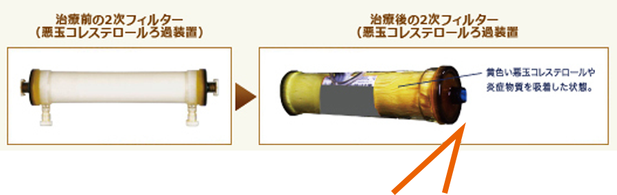 第2层过滤膜对比照
